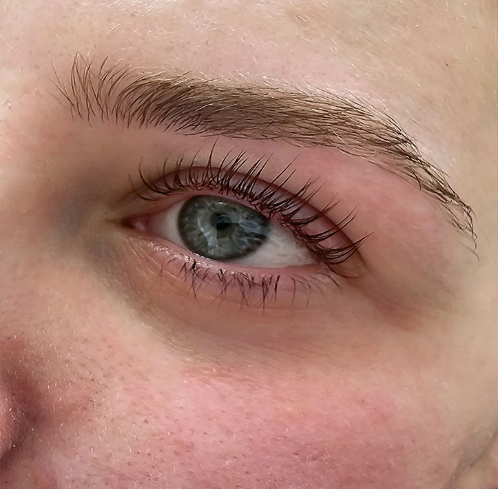 lash treatment