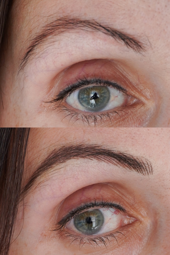 Hyper Nano Brows 2 Hyper Nano Brows Williamstown Melbourne — The Ink & Lash Clinic