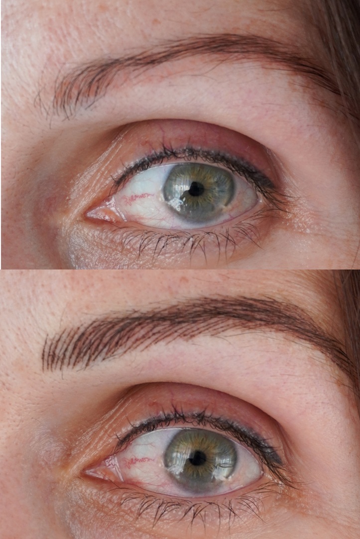 HyperNano Brows 1